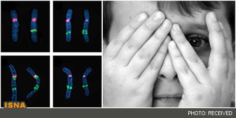 کشف رابطه فقدان آنزیم مغزی با سطوح غیرطبیعی ترس