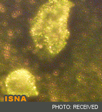 کشف مکانیزم جدید برای درمان سرطان تخمدان با نانوذرات طلا