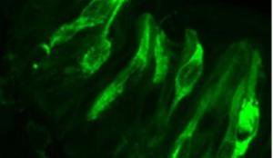 چاقی حس چشایی را تغییر می‌دهد!