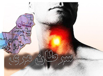 سرطان مري