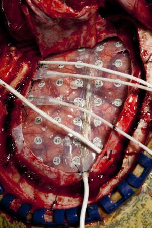 چشم، بازوی مغز در شنوایی است