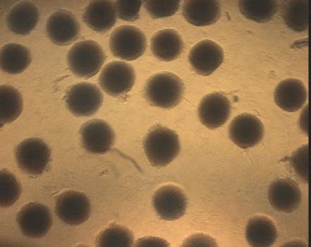 درمان نویدبخش دیابت و سرطان با اسفنج هوشمند قابل تزریق