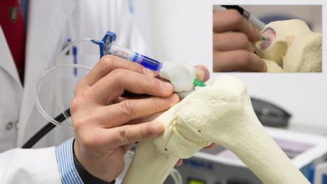 طراحی بافت جدید استخوان با «قلم زیستی»