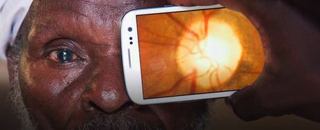 تشخیص عارضه «آب مروارید» با برنامه گوشی هوشمند