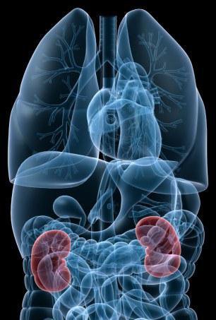 درمان سرطان کلیه با رنگ کردن اندام!