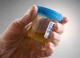 ترکیب کامل ادرار با کشف 3 هزار ماده شیمیایی شناسایی شد