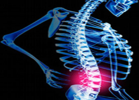 ایمپلنت جدید ستون فقرات برای کمک به بیماران فلج 