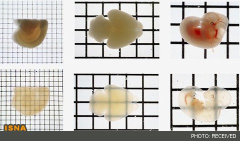 رصد اعماق مغز و اعضای بدن با شربت قند!