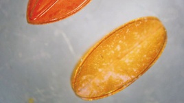 جلوگیری از نابینایی با ریزربات‌های تزریقی!