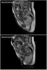 نخستين تصاوير MRI‌ از لحظه تولد نوزاد