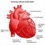 درمان نوین عروق مسدود شده قلب با ابزار جدید