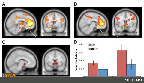 صحبت‌کردن درباره خود مغز را شاد می‌کند