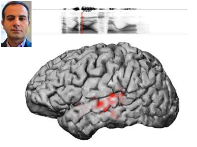 پرده‌برداری از نحوه شناسایی اصوات کلامی توسط مغز با همکاری دانشمند ایرانی