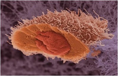 دارورسانی به سلول‌های سرطان پروستات با نانوقفس‌ها