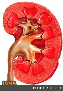 قبل از شروع رمضان، سلامت کلیه‌تان را چک کنید 