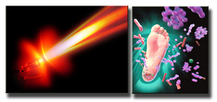 دیابت، عامل 60 درصد موارد قطع عمدی اندام هاست