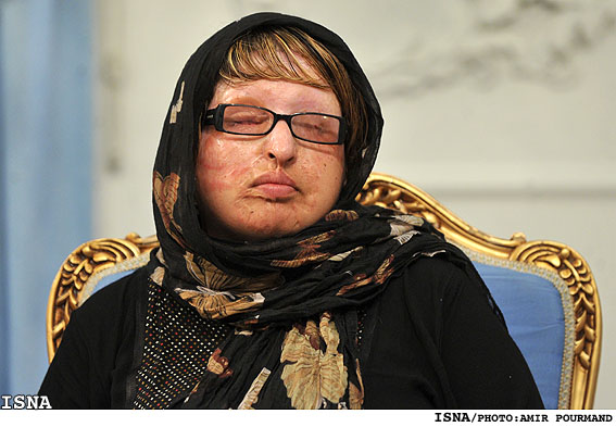 در پي رسيدگي به جنبه عمومي جرم؛
پرونده خواستگار اسيدپاش «آمنه» به دادسرا بازگردانده شد