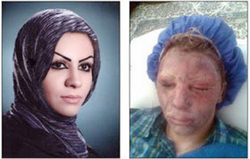 قصاص يا عدم‌ قصاص؛ اصلا مساله اين نيست!
معصومه، از كتك‌هاي شوهر تا طلاق و اسيدپاشي پدرشوهر
خرمشاهي: دادگاه كيفري اصفهان تعيين وقت كرده اما ابلاغ نشده است
