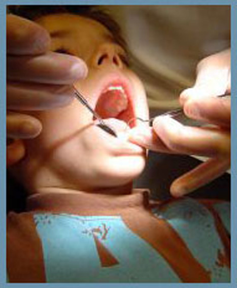 تماس با مواد قليايي خطر آسيب‌هاي دنداني را افزايش مي‌دهد